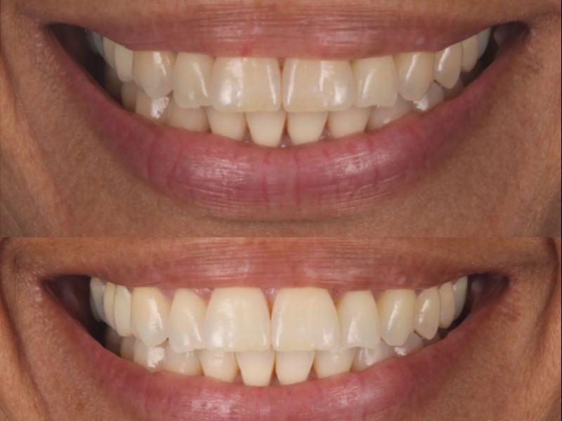 Caso 01 — antes e depois do tratamento